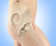 Minimally Invasive Hip Replacement - Direct Anterior Approach - Services