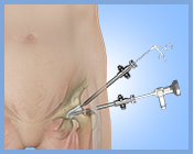 Hip Arthroscopy - Services