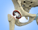 Revision Total Hip Surgery - Services