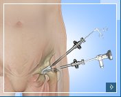 Hip Arthroscopy