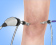 Knee Arthroscopy - Services