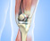 Total Knee Replacement - Services