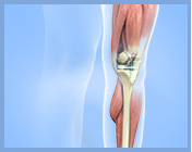 Total Knee Replacement Link - Services